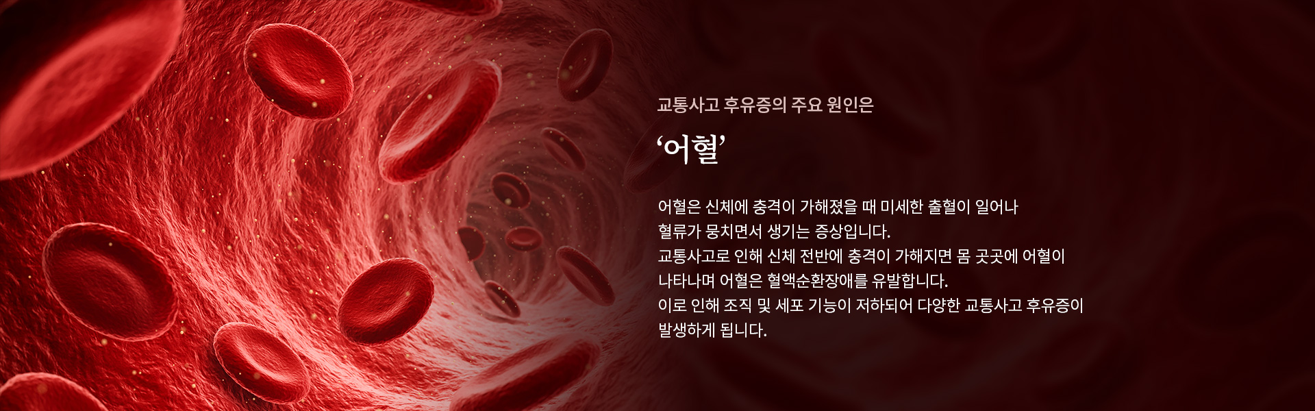 교통사고 후유증_02